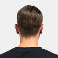 hairsystems-heydecke-hey-I-HDP-tim-bauer-vorher-nachher-1080x1080-03