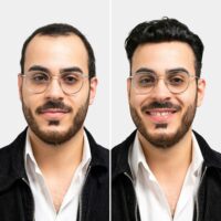 hairsystems-heydecke-hey-IV+-sedat-vorher-nachher-1080x1080-01